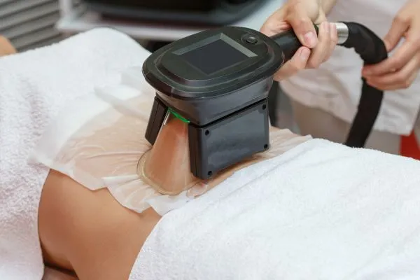 Image of person having fat freezing treatment to help weight gain Teddington
