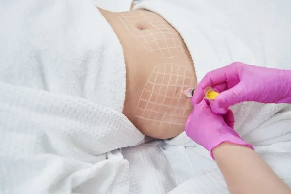 image of fat dissolving injections on love handles to help combat weight gain Teddington