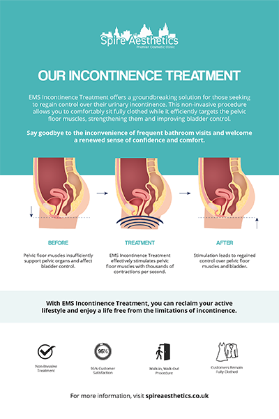 image of how urge incontinence Teddington treatment works