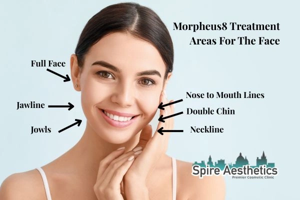Where can Morpheus8 Treatment Teddington be done on the body?