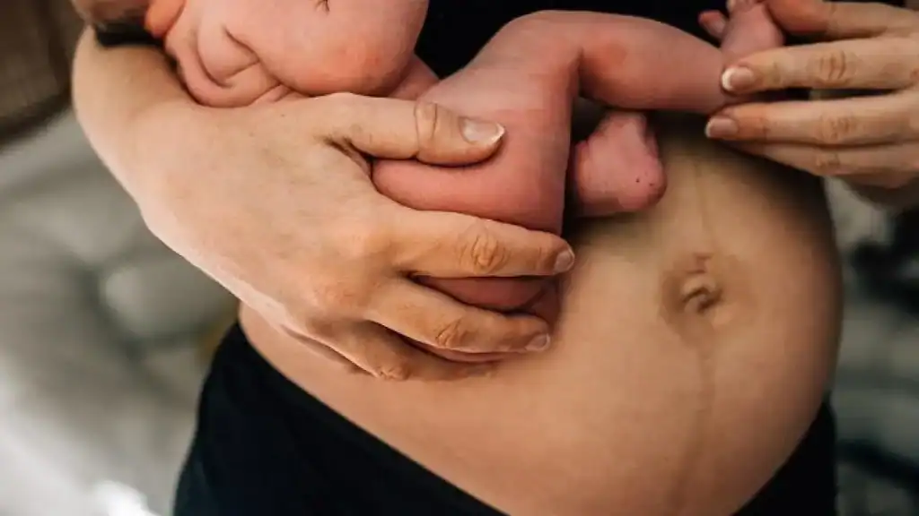 Why Is My Stomach Still Big After Pregnancy Teddington?